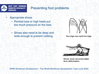 Preventing foot problems
• Appropriate shoes
– Pointed toes or high heels put
too much pressure on the toes.
– Shoes also need to be deep and
wide enough to prevent rubbing.
DPMI Workforce Development – The Alfred Workforce Development Team June 2005
 