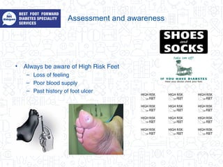 Assessment and awareness
• Always be aware of High Risk Feet
– Loss of feeling
– Poor blood supply
– Past history of foot ulcer
 