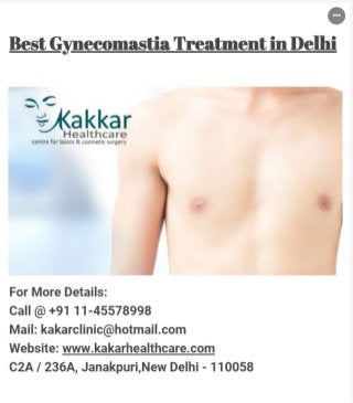 Best Gynecomastia Treatment in Delhi