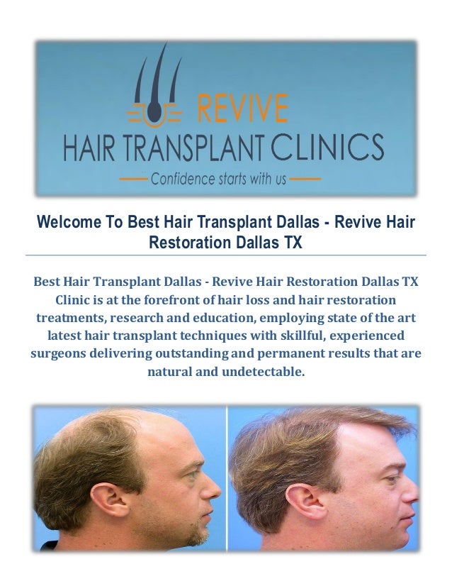 Best Hair Transplant Dallas Revive Hair Restoration in Dallas