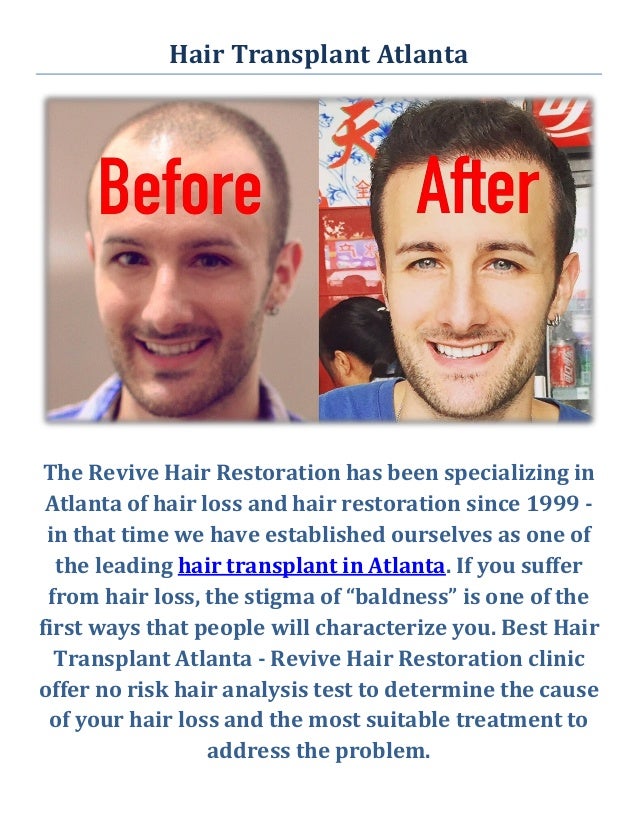 Best Hair Transplant in Atlanta GA Revive Hair Restoration