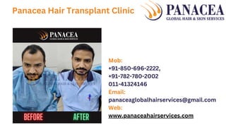 Panacea Hair Transplant Clinic
Mob:
+91-850-696-2222,
+91-782-780-2002
011-41324146
Email:
panaceaglobalhairservices@gmail.com
Web:
www.panaceahairservices.com
 