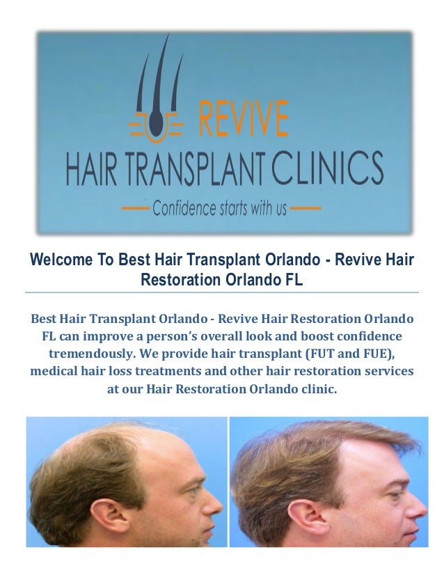 Hair Transplant Orlando Hair Restoration Orlando Best | hair restoration orlando fl om hair Hair Transplant Orlando Hair Restoration Orlando Best | hair restoration orlando fl om hair