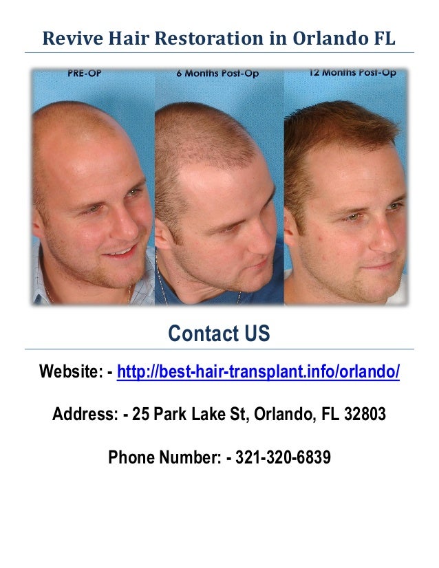Best Hair Transplant Doctors In America | best hair transplant doctors in america best hair Best Hair Transplant Doctors In America | best hair transplant doctors in america best hair