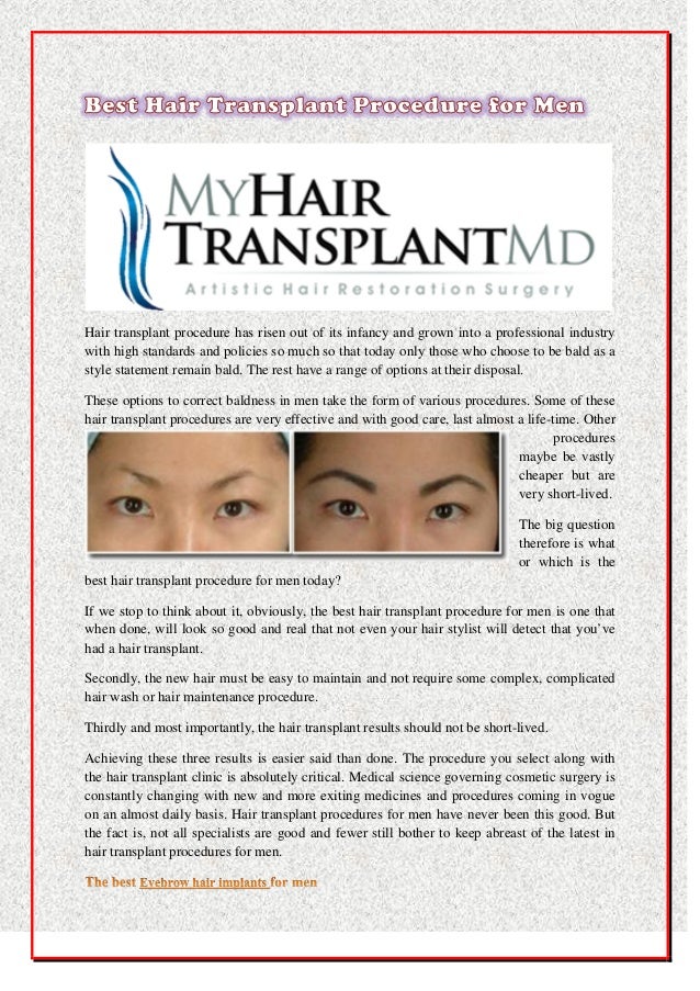 Best Hair Transplant Procedure