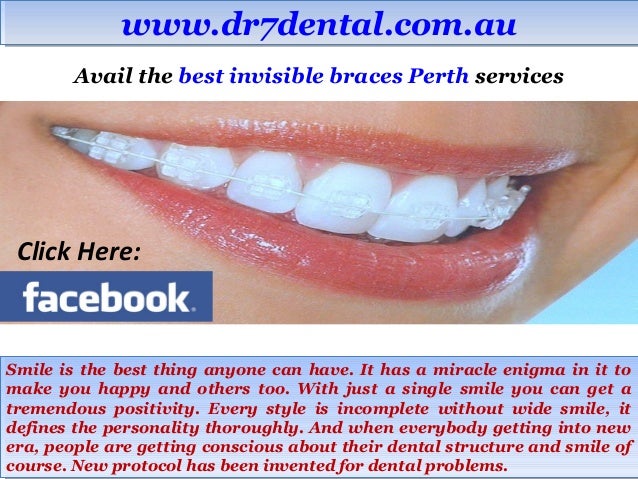 best invisible braces