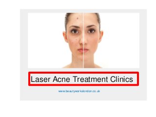 Laser Acne Treatment Clinics
www.beautyworkslondon.co.uk
 