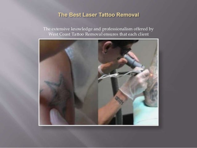 best laser tattoo removal in vancouver bc best laser tattoo removal in vancouver bc