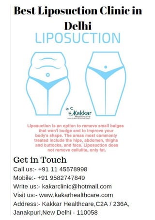 Best liposuction clinic in Delhi