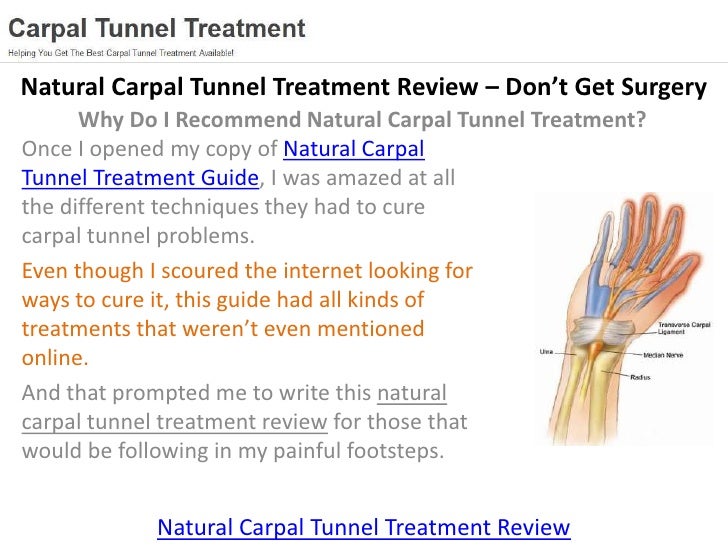 Best Natural Carpal Tunnel Treatment Review