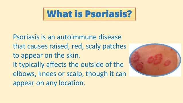 How To Get Rid Of Autoimmune Disease Naturally How To Get Rid Of Autoimmune Disease Naturally
