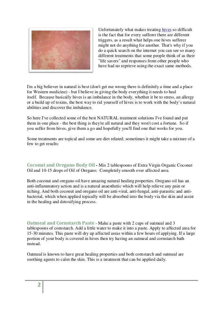 Best Natural Treatments for Hives Best Natural Treatments for Hives