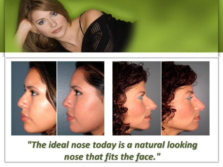 Best nose job surgeon