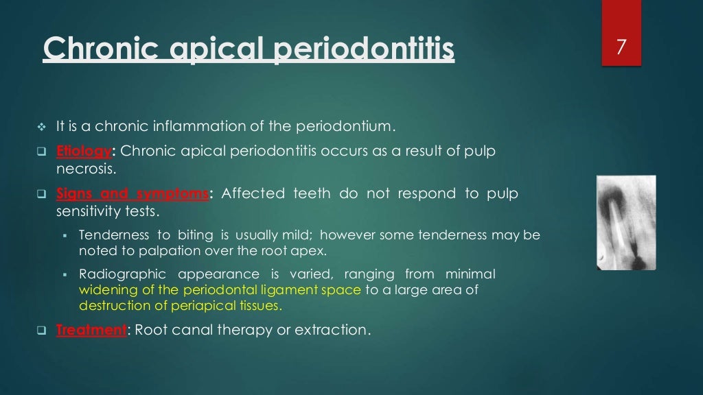 Best notes on classification of periapical disease