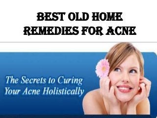 Best Old Home
Remedies For Acne
 