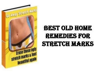 Best Old Home
 Remedies For
Stretch Marks
 
