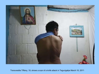 Transvestite Tiffany, 19, shows a scar of a knife attack in Tegucigalpa March 10, 2011   