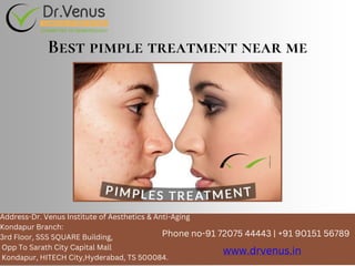 Address-Dr. Venus Institute of Aesthetics & Anti-Aging
Kondapur Branch:
3rd Floor, SSS SQUARE Building,
Opp To Sarath City Capital Mall
Kondapur, HITECH City,Hyderabad, TS 500084.
Phone no-91 72075 44443 | +91 90151 56789
www.drvenus.in
Best pimple treatment near me
 
