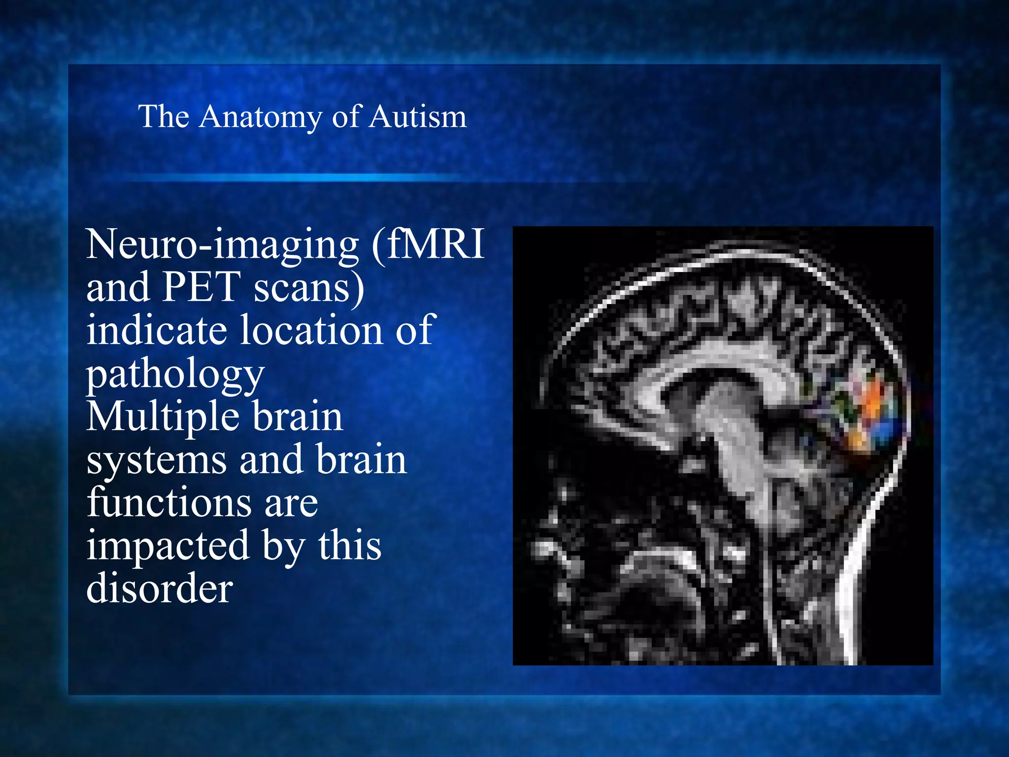 The Anatomy of Autism


Neuro-imaging (fMRI
and PET scans)
indicate location of
pathology
Multiple brain
systems and brain
functions are
impacted by this
disorder
 