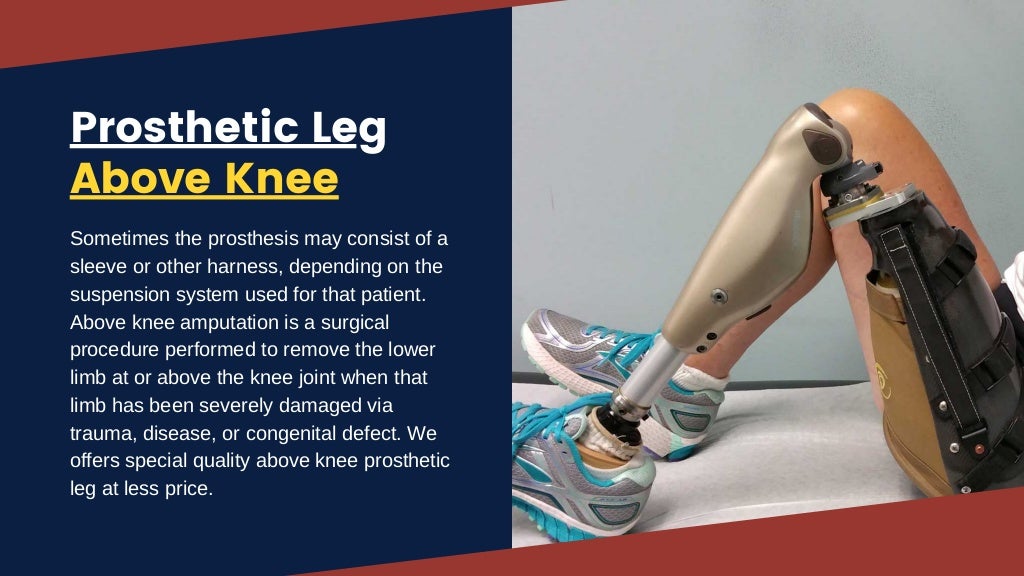 Best Prosthetic Leg Above Knee by Rinella Prosthetics & Orthotics