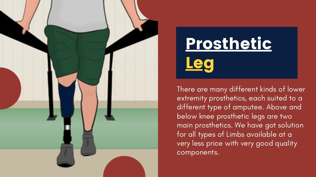 Best Prosthetic Leg Above Knee by Rinella Prosthetics & Orthotics