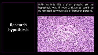 Research
hypothesis
IAPP misfolds like a prion protein, so the
hypothesis was if type 2 diabetes could be
transmitted between cells or between persons.
 