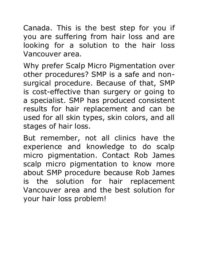 Best Rated Hair Replacement Systems