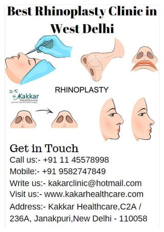 Best rhinoplasty clinic in West Delhi