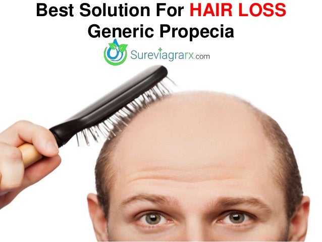 generic propecia any good