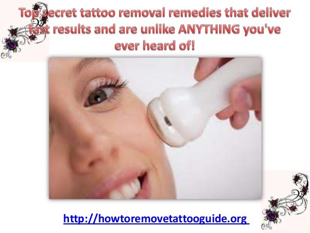 Best Tattoo Removal Machines, Reviews, Price Range