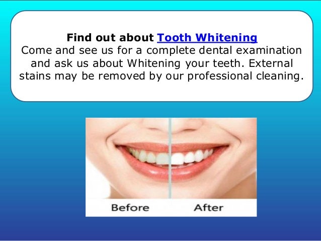 Best teeth whitening treatment at mooneevaledental