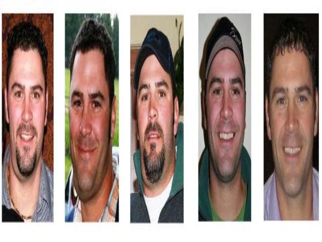 Best Treatment for Sarcoidosis