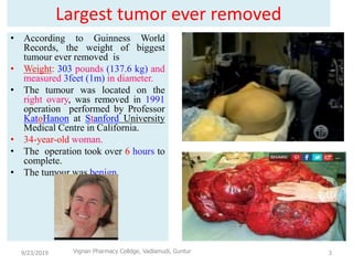 Largest tumor ever removed
• According to Guinness World
Records, the weight of biggest
tumour ever removed is
• Weight: 303 pounds (137.6 kg) and
measured 3feet (1m) in diameter.
• The tumour was located on the
right ovary, was removed in 1991
operation performed by Professor
KatoHanon at Stanford University
Medical Centre in California.
• 34-year-old woman.
• The operation took over 6 hours to
complete.
• The tumour was benign.
9/23/2019 3Vignan Pharmacy Colldge, Vadlamudi, Guntur
 