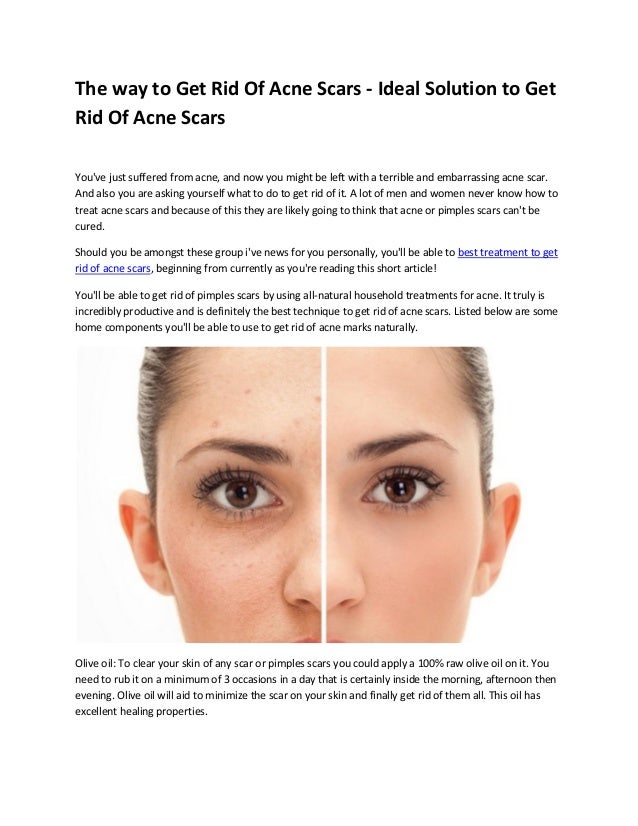 best treatment to get rid of acne scars