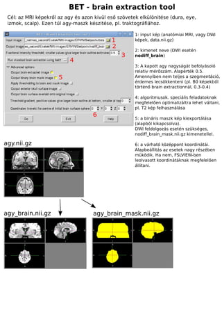 BET - brain extraction tool
 Cél: az MRI képekről az agy és azon kivül eső szövetek elkülönitése (dura, eye,
 izmok, scalp). Ezen túl agy-maszk készitése, pl. traktográfiához.

                                                      1: input kép (anatómiai MRI, vagy DWI
                                            1         képek, data.nii.gz)
                                            2
                                                      2: kimenet neve (DWI esetén
                                                3     nodiff_brain)
                           4
                                                      3: A kapott agy nagyságát befolyásoló
                                                      relativ mérőszám. Alapérték 0.5.
                      5                               Amennyiben nem teljes a szegmentáció,
                                                      érdemes lecsökkenteni (pl. B0 képekből
                                                      történő brain extractionnál, 0.3-0.4)

                                                      4: algoritmusok. speciális feladatoknak
                                                      megfelelően optimalizáltra lehet váltani,
                                                      pl. T2 kép felhasználása
                                    6
                                                      5: a bináris maszk kép kiexportálása
                                                      (alapból kikapcsolva).
                                                      DWI feldolgozás esetén szükséges,
                                                      nodiff_brain_mask.nii.gz kimenetellel.

agy.nii.gz                                            6: a várható középpont koordinátái.
                                                      Alapbeállitás az esetek nagy részében
                                                      müködik. Ha nem, FSLVIEW-ben
                                                      leolvasott koordinátáknak megfelelően
                                                      állitani.




agy_brain.nii.gz                    agy_brain_mask.nii.gz
 