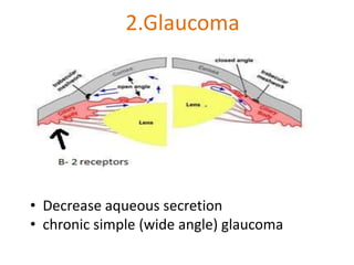2.Glaucoma
• Decrease aqueous secretion
• chronic simple (wide angle) glaucoma
 