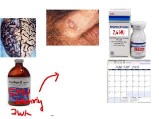 Beta lactam antibiotics