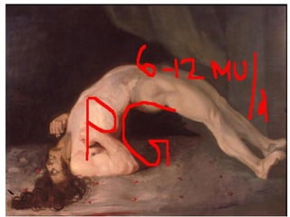 Beta lactam antibiotics