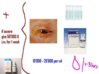 Beta lactam antibiotics