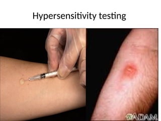 Hypersensitivity testing
 