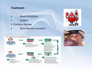 Treatment :
• Blood transfusion
• Surgery
• Chelation therapy
• Bone Marrow transplant
 