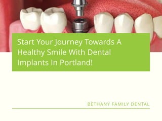 Dental implant Surgery After Care Guide | PPTX