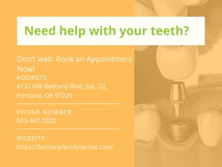 Dental implant Surgery After Care Guide | PPTX