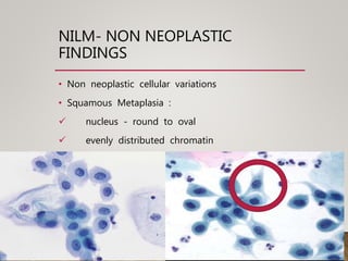 NILM- NON NEOPLASTIC
FINDINGS
• Non neoplastic cellular variations
• Squamous Metaplasia :
 nucleus - round to oval
 evenly distributed chromatin
 in conventional smears – spider cells
 