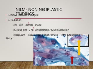 NILM- NON NEOPLASTIC
FINDINGS• Reactive cellular changes :
• 3. Radiation :
cell size ,bizarre shape
nucleus size / N , Binucleation / Multinucleation
cytoplasm - vacuolated polychromatic , intra cytoplasmic
PML’s
 