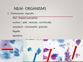 NILM- ORGANISMS
1. Trichomonas vaginalis :
Pear shaped cyanophilic
nucleus – pale , vesicular , eccintrically
cytoplasm – eosinophilic granules
flagella
leptothrix
squamous cell TRICH change , polyballs
 
