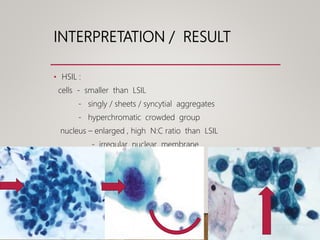 INTERPRETATION / RESULT
• HSIL :
cells - smaller than LSIL
- singly / sheets / syncytial aggregates
- hyperchromatic crowded group
nucleus – enlarged , high N:C ratio than LSIL
- irregular nuclear membrane
 