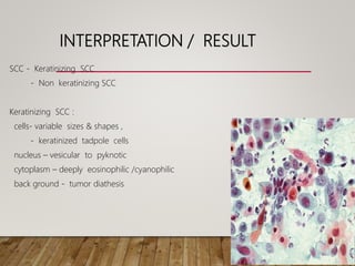 INTERPRETATION / RESULT
SCC - Keratinizing SCC
- Non keratinizing SCC
Keratinizing SCC :
cells- variable sizes & shapes ,
- keratinized tadpole cells
nucleus – vesicular to pyknotic
cytoplasm – deeply eosinophilic /cyanophilic
back ground - tumor diathesis
 