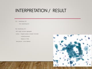 INTERPRETATION / RESULT
SCC - Keratinizing SCC
- Non keratinizing SCC
Non Keratinizing SCC :
cells- singly / syncytial aggregates
nucleus – irregular coarsely clumped chromatin
- nucleoli prominent
- features of HSIL
back ground - tumor diathesis
 