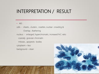 INTERPRETATION / RESULT
• AIS :
cells - sheets , clusters , rosettes ,nuclear crowding &
Overlap , feathering
nucleus - enlarged, hyperchromatic, increased N:C ratio
coarsely granular chromatin
mitoses , apoptotic bodies
cytoplasm – less
background – clean
 